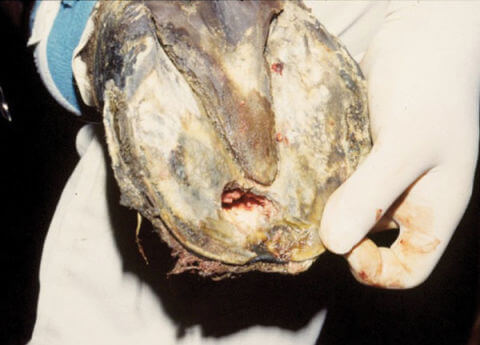 abscess of hoof